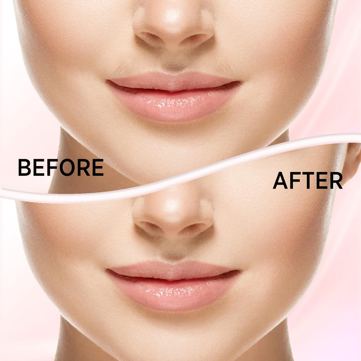 Facial Hair Removal for Women L169854
